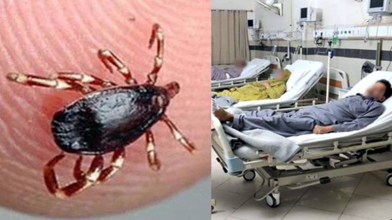 Death Toll from Congo Virus Rises to 16 in Quetta